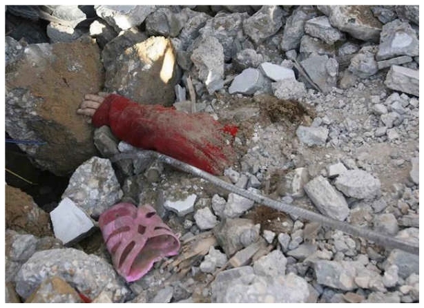 Pic 13 Child's Arm in Rubble 02202009